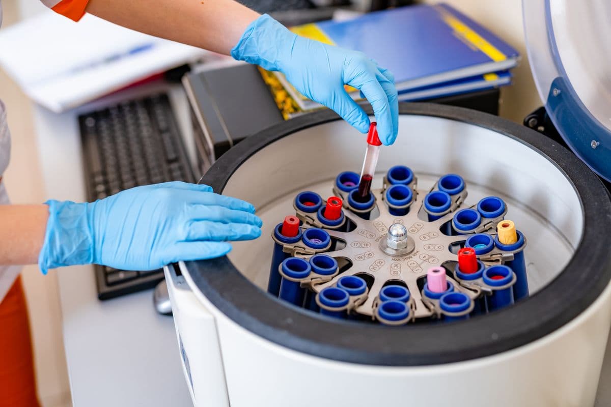 High-Speed PRP Centrifuge
