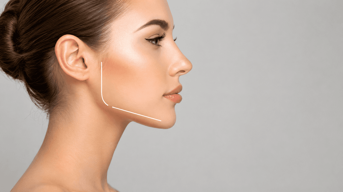 V – line Jaw Contouring Surgery treatment at NFSC, Mumbai